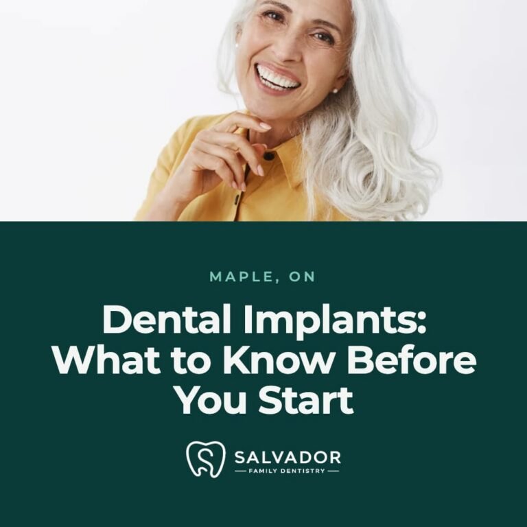 Dental Implants in Maple: What to Know Before You Start